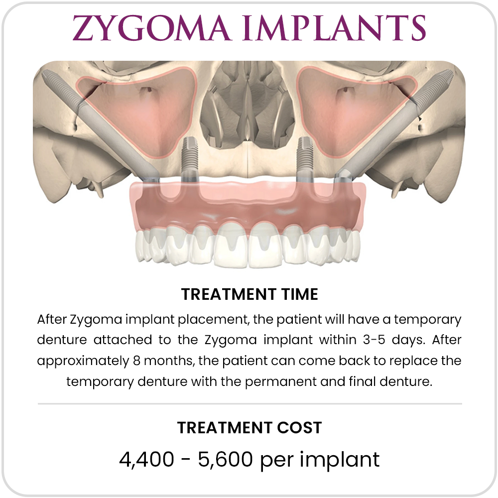 Zygoma_Implants-1