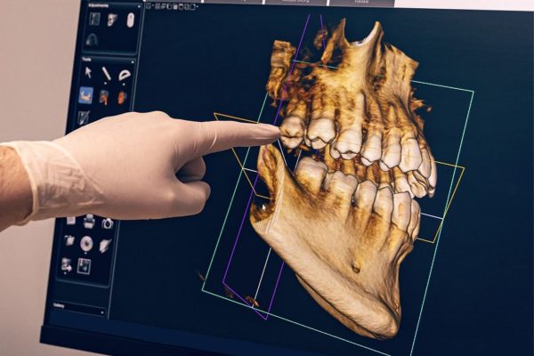 THE CBCT ADVANTAGE