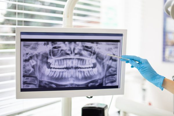 Oral Surgery & Restorative Care