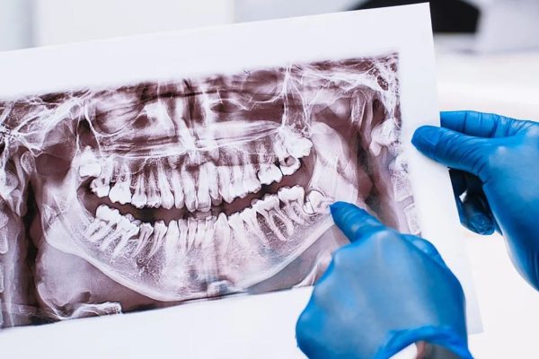 SAFETY IN CBCT IMAGING