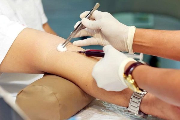 SURGERY UNDER GENERAL ANAESTHESIA